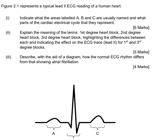 SOLVED: Figure 2.1 represents a typical lead II ECG reading of a human ...