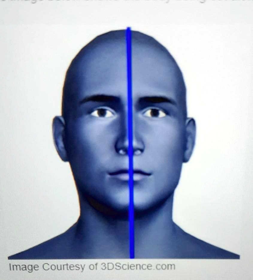 SOLVED The image below shows the body being cut along what plane