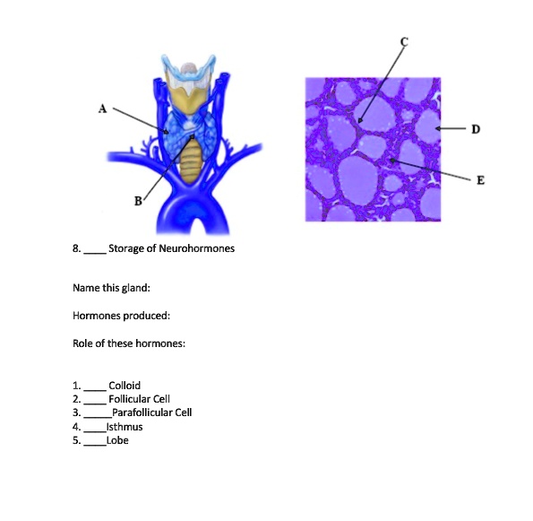 SOLVED: Storage of Neurohormones Name this gland: Hormones produced ...