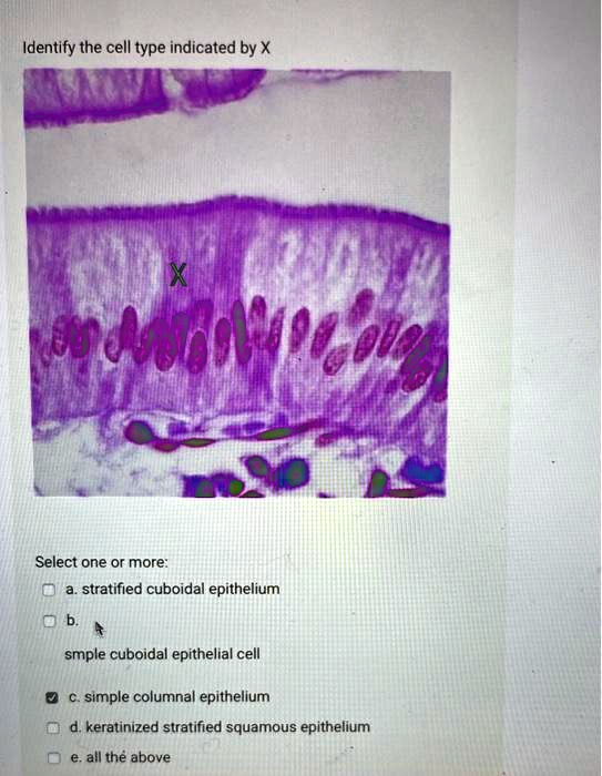 SOLVED: Identify the cell type indicated by X I derd raole Select one ...