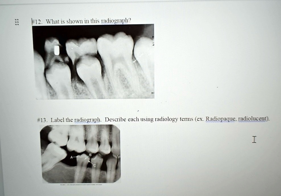 SOLVED 12. What is shown in this radiograph? 13. Label the