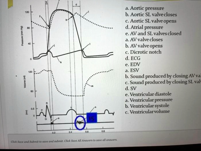 SOLVED Aortic pressure Aortic SL valve closes Aortic SL valve opens