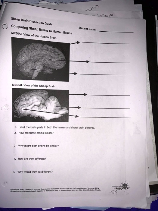 SOLVED Sheep Brain Dissection Guide Comparing Sheep Brains to Human
