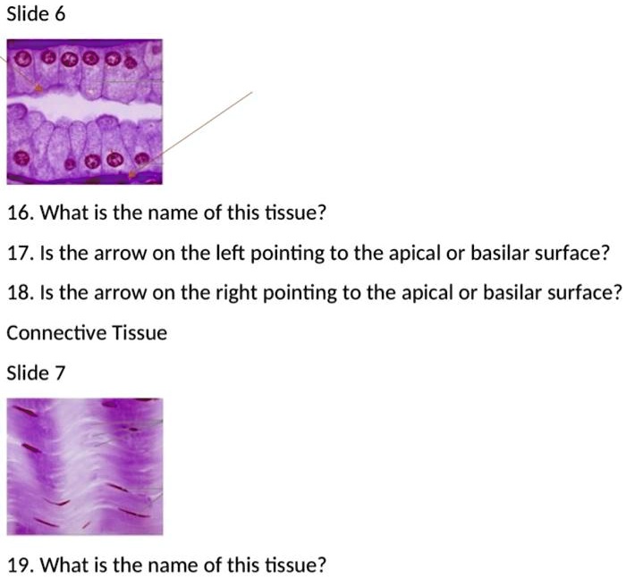 16. What is the name of this tissue?
17. Is the arrow on the left pointing to the apical or basilar surface?
18. Is the arrow on the right pointing to the apical or basilar surface?
Connective Tissue
19. What is the name of this tissue?