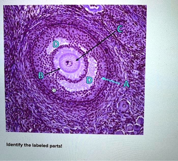 SOLVED: B Identify The Labeled Parts!