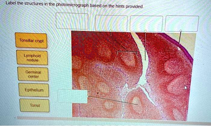 SOLVED: Label the structures in the photomicrograph based on the hints ...