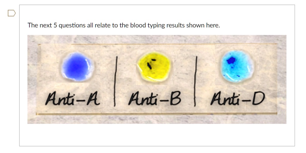 SOLVED: J1- Based On The Blood Typing Results Shown Above, List All Of ...