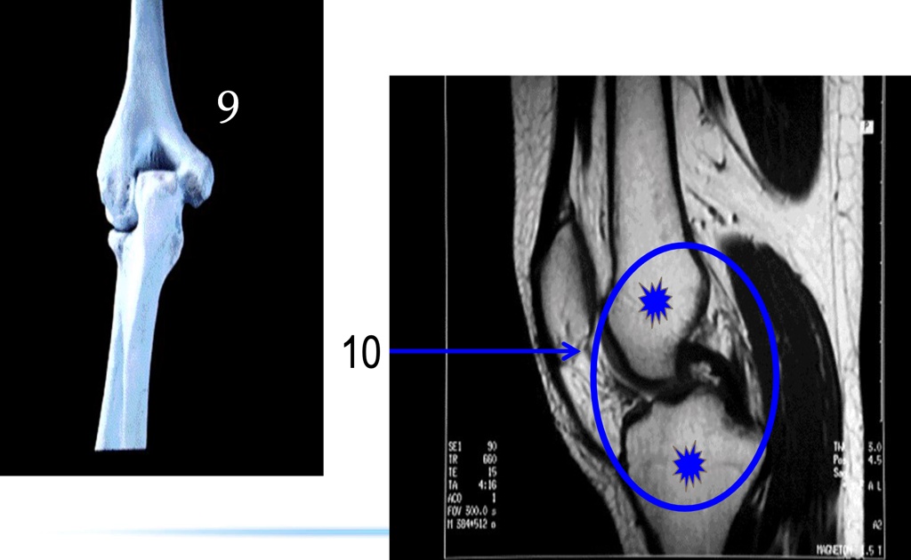 SOLVED Joints/Articulations Format for both questions A. Joint name B