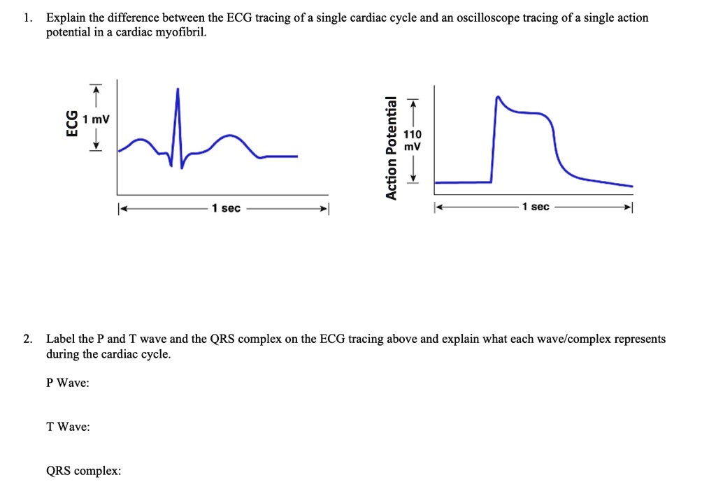 SOLVED 1. Explain the difference between the ECG tracing of a single cardiac cycle and an
