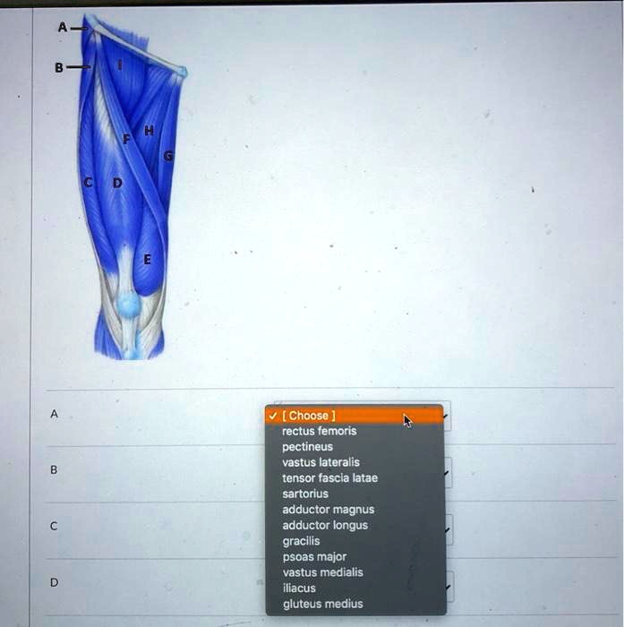 SOLVED Rectus femoris, pectineus, vastus lateralis, tensor fascia