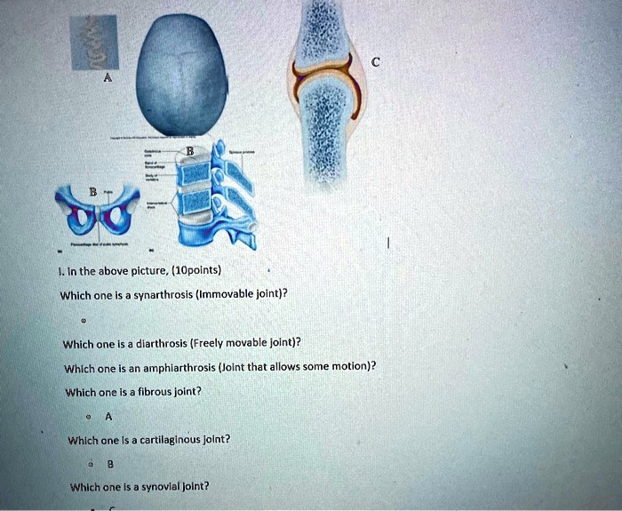 A
B
B
C
I. In the above picture, (10points)
Which one is a synarthrosis (Immovable joint)?
Which one is a diarthrosis (Freely movable joint)?
Which one is an amphiarthrosis (Joint that allows some motion)?
Which one is a fibrous joint?
A
Which one is a cartilaginous joint?
B
Which one is a synovial joint?