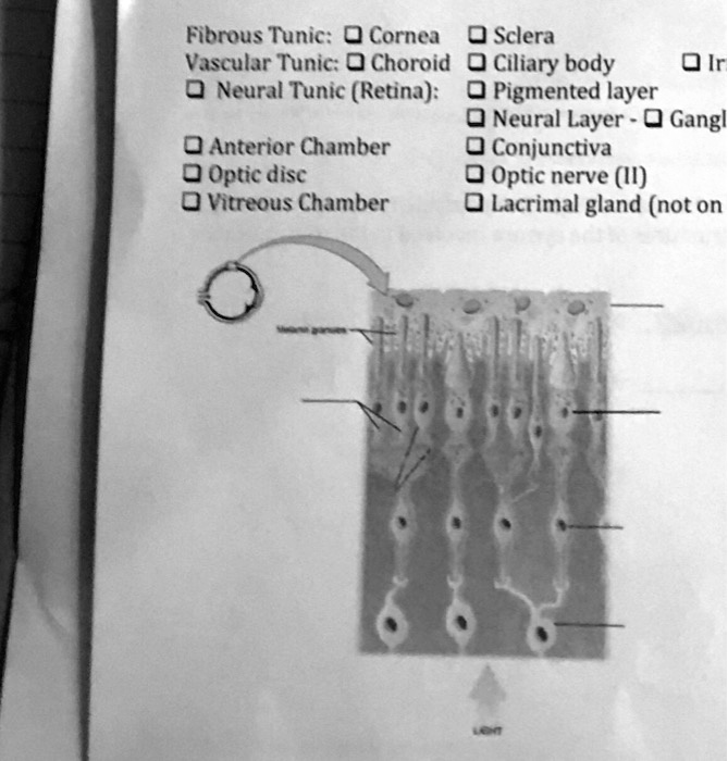 Fibrous Tunic: Cornea Sclera
Vascular Tunic: Choroid Ciliary body Iris
Neural Tunic (Retina): Pigmented layer
Neural Layer - Ganglion
Anterior Chamber Conjunctiva
Optic disc Optic nerve (II)
Vitreous Chamber Lacrimal gland (not on)
Melanin granules
LIGHT