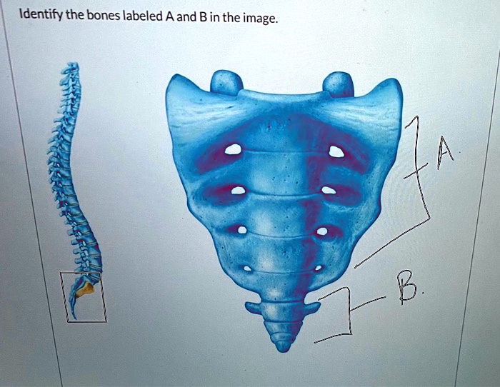 SOLVED: Identify The Bones Labeled A And B In The Image