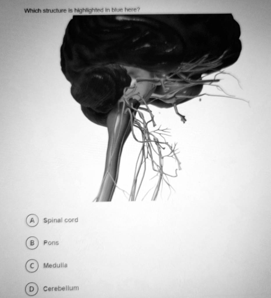 SOLVED: 'Which Structure Is Highlighted In Blue Here? Spinal Cord B ...