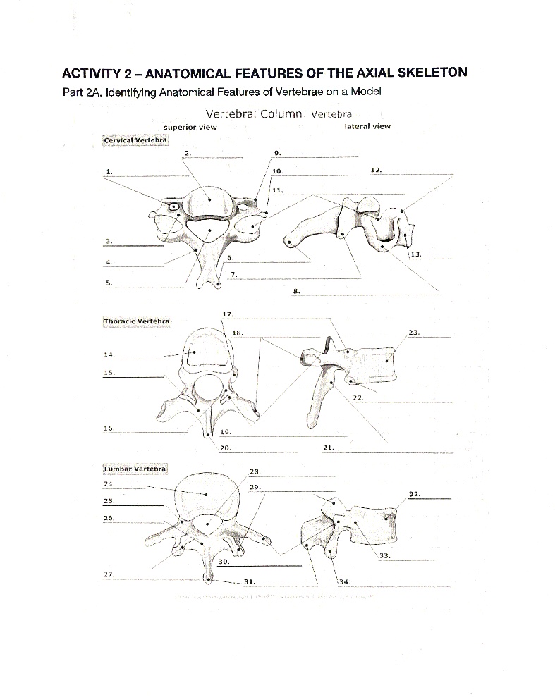 SOLVED: Thoracic and Lumbar Vertebra only please (#14-#34) ACTIVITY 2