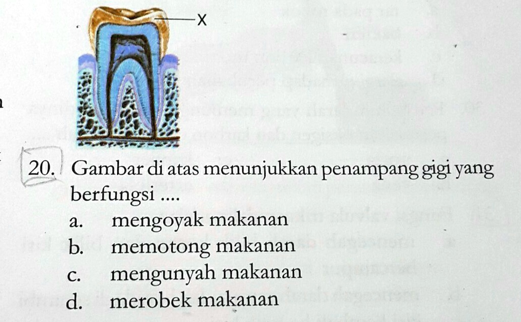 SOLVED: Gambar Di Atas Menunjukkan Penampang Gigi Yang Berfungsi ... 20 ...