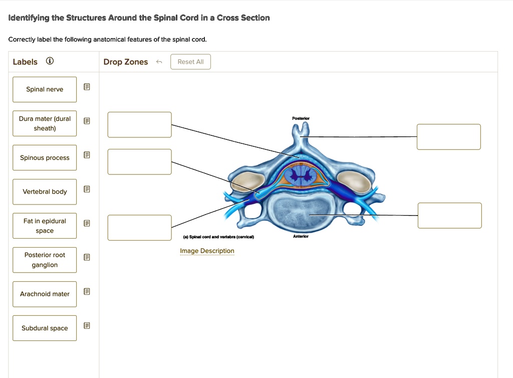 Identifying the Structures Around the Spinal Cord in a Cross Section