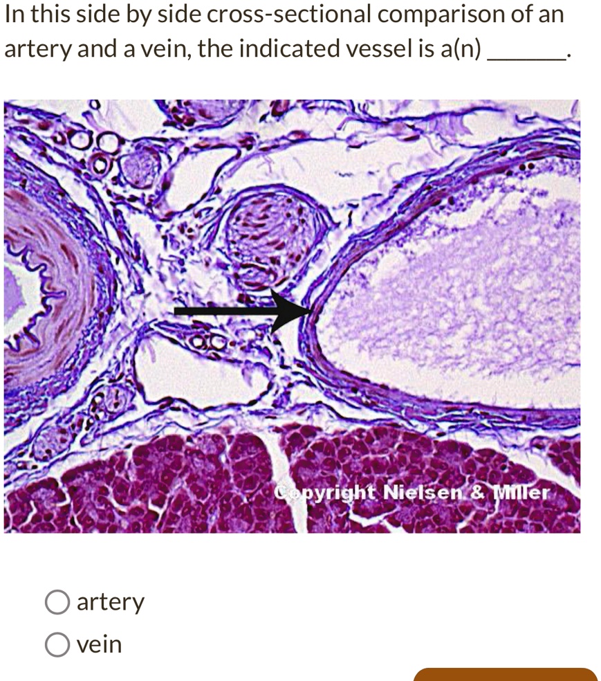 SOLVED: In this side-by-side cross-sectional comparison of an artery ...