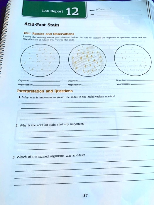 Lab Report 12
Name Verena i
Date
Acid-Fast Stain
Your Results and Observations
Record the staining results you observed below. Be sure to include the organism or specimen name and the magnification at which you viewed the slide.
Organism:
Magnification:
Organism:
Magnification:
Organism:
Magnification:
Interpretation and Questions
1. Why was it important to steam the slides in the Ziehl-Neelsen method?
2. Why is the acid-fast stain clinically important?
3. Which of the stained organisms was acid-fast?
57