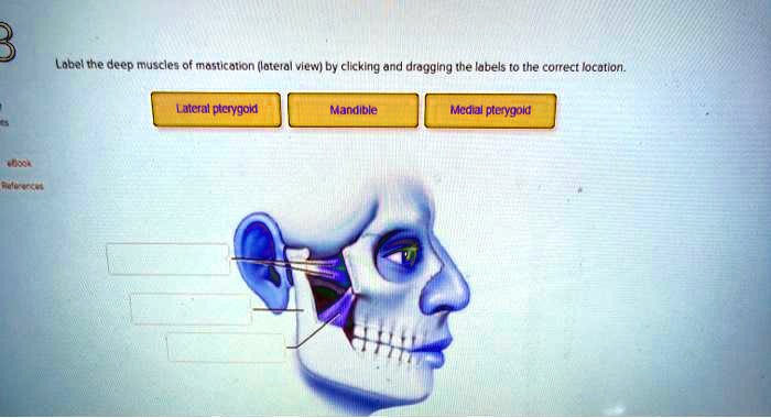 SOLVED: Label the deep muscles of mastication lateralview by clicking ...