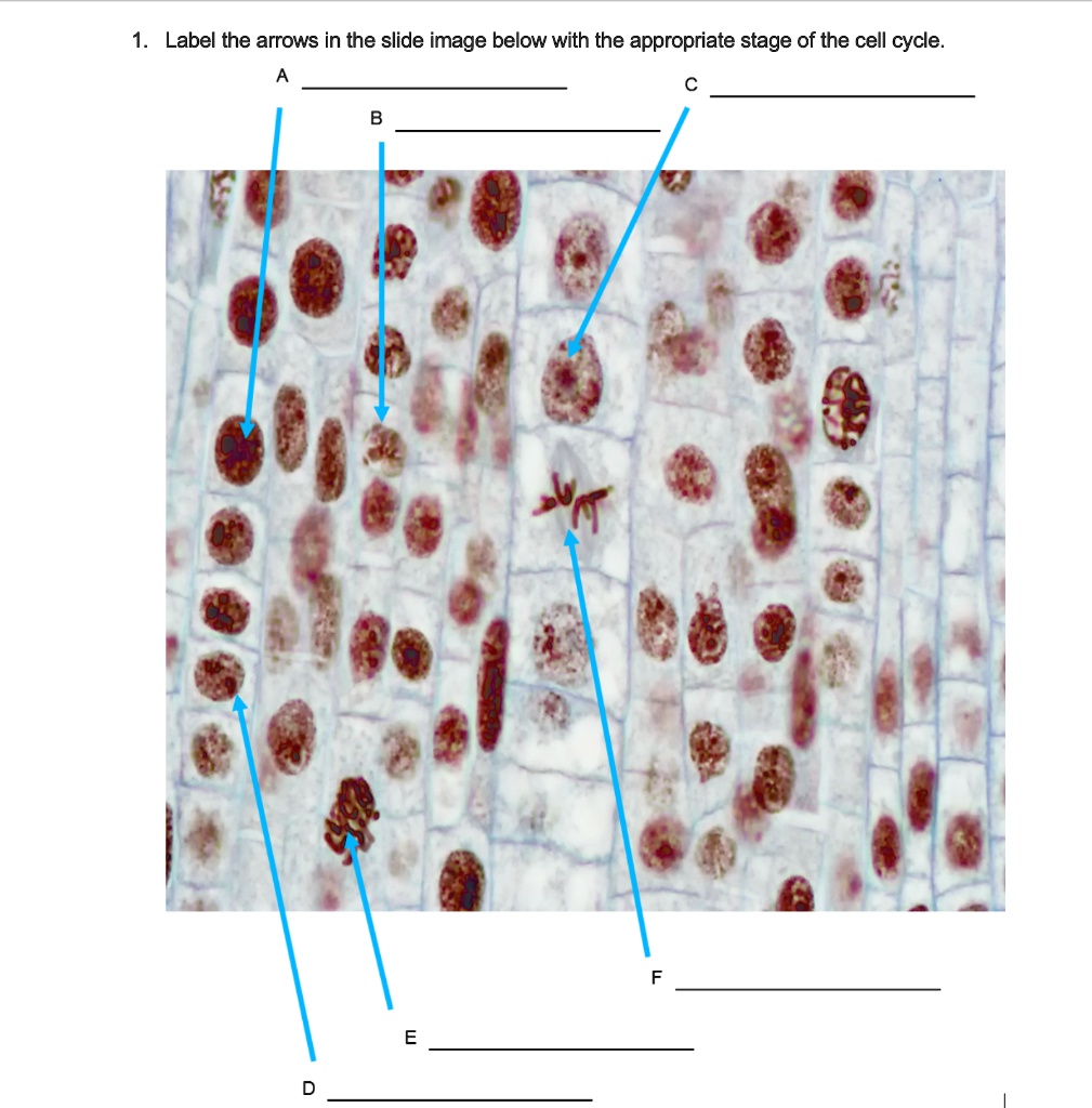 1. Label the arrows in the slide image below with the appropriate stage ...
