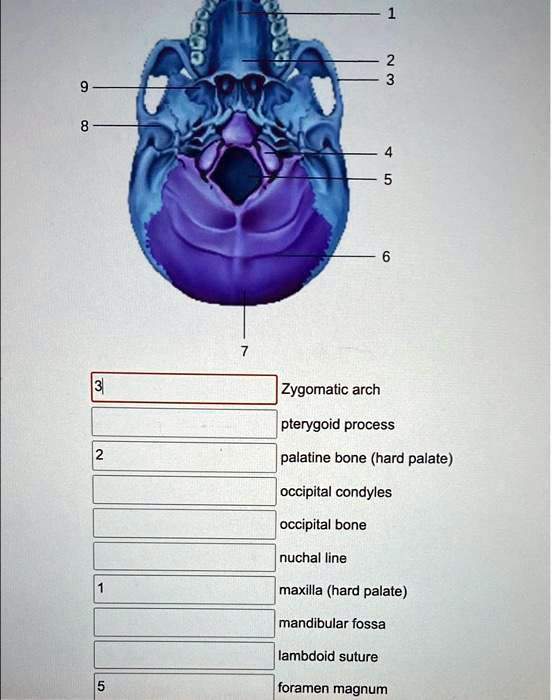 Solved Zygomatic Arch Pterygoid Process Palatine Bone Hard Palate Occipital Condyles 7957