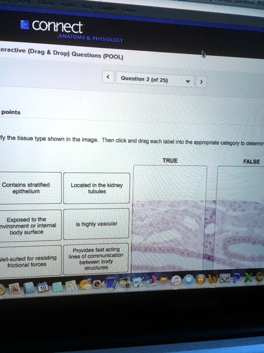 Identify the tissue type shown in the image. Then click and drag each label into the appropriate category to determine
TRUE
FALSE
Contains stratified epithelium
Located in the kidney tubules
Exposed to the environment or internal body surface
Is highly vascular
Provides fast acting lines of communication between body structures
Well-suited for resisting frictional forces