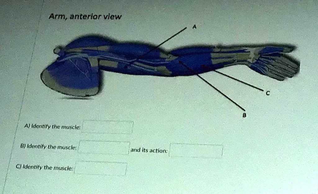 SOLVED Arm,anterior view Adearify the muscle B Identify the muscle and