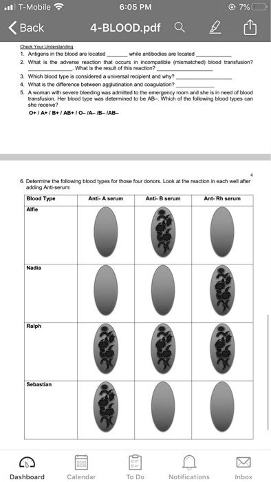 Check Your Understanding
1. Antigens in the blood are located  while antibodies are located 
2. What is the adverse reaction that occurs in incompatible (mismatched) blood transfusion?
. What is the result of this reaction?
3. Which blood type is considered a universal recipient and why?
4. What is the difference between agglutination and coagulation?
5. A woman with severe bleeding was admitted to the emergency room and she is in need of blood
transfusion. Her blood type was determined to be AB-. Which of the following blood types can
she receive?
O+ / A+ / B+ / AB+ / O- /A- /B- /AB-
6. Determine the following blood types for those four donors. Look at the reaction in each well after
adding Anti-serum:
Blood Type
Anti- A serum
Anti- B serum
Ant- Rh serum
Alfie
Nadia
Ralph
Sebastian