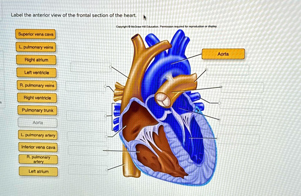 SOLVED: Label the anterior view of the frontal section of the heart ...