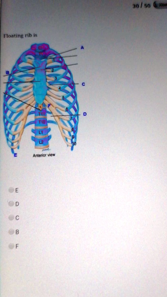 Floating rib is
A
B
C
D
E
F
1
2
3
4
5
6
7
8
9
10
C7
T1
T11
T12
L1
L2
Anterior view
E
D
C
B
F