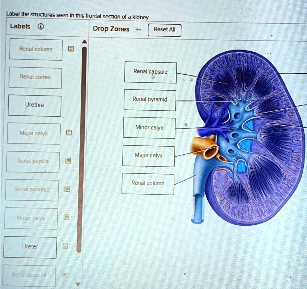 Label the structures seen in this frontal section of a kidney: - Renal ...