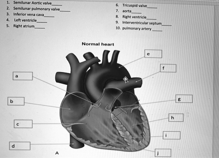 SOLVED: 1. Semilunar Aortic valve 2. Semilunar pulmonary valve 3 ...
