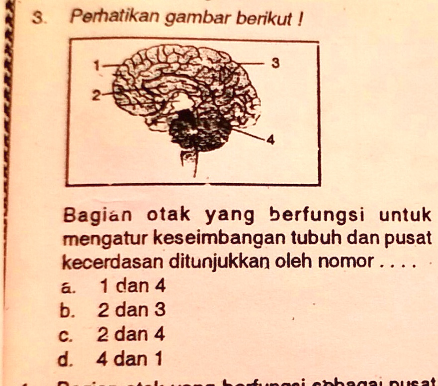 SOLVED: Perhatikan Gambar Berikut. Bagian Otak Yang Berfungsi Untuk ...