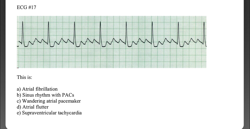 ECG #17 This is: a) Atrial fibrillation b) Sinus rhythm with PACs c ...