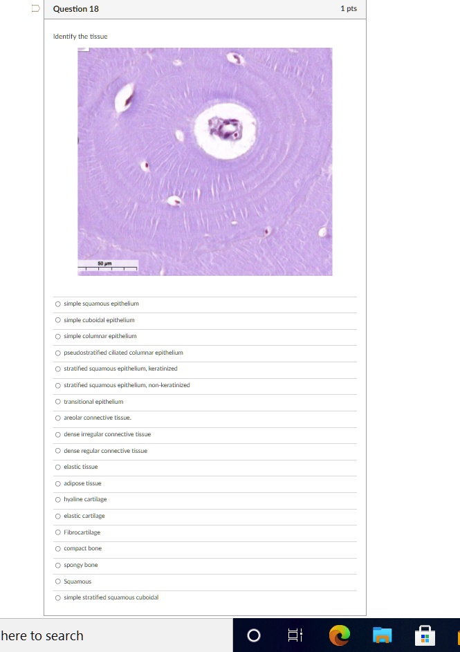 Identify the tissue simple squamous epithelium simple cuboidal