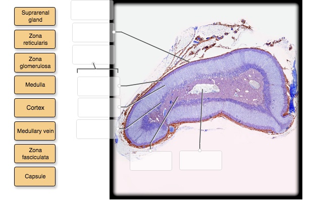SOLVED: Label the photomicrograph based on the hints provided ...