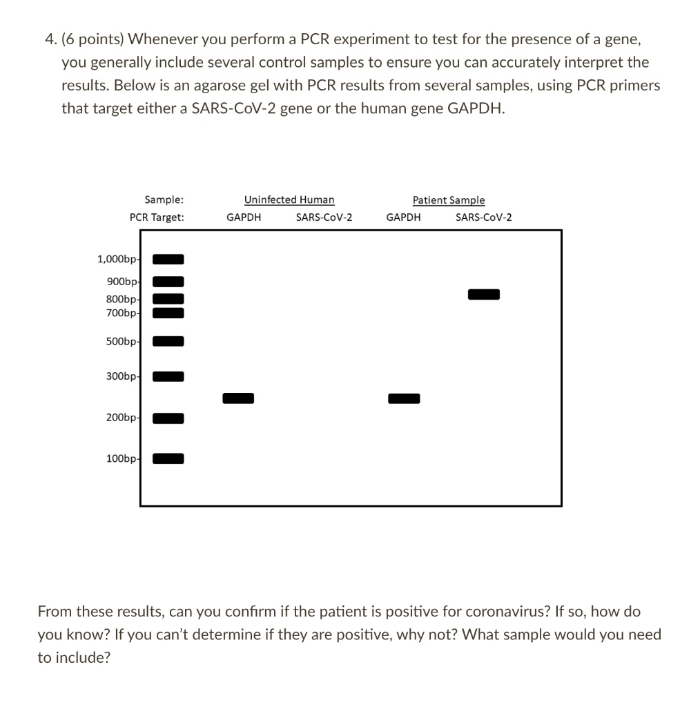 SOLVED: Whenever you perform a PCR experiment to test for the presence ...