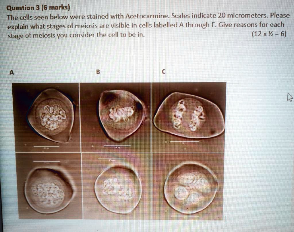 Solved Question 3 6 Marks The Cells Seen Below Were Stained With Acetocarmine Scales Indicate Micrometers Please Explain What Stages Of Meiosis Are Visible In Cells Labelled A Through F Give Reasons