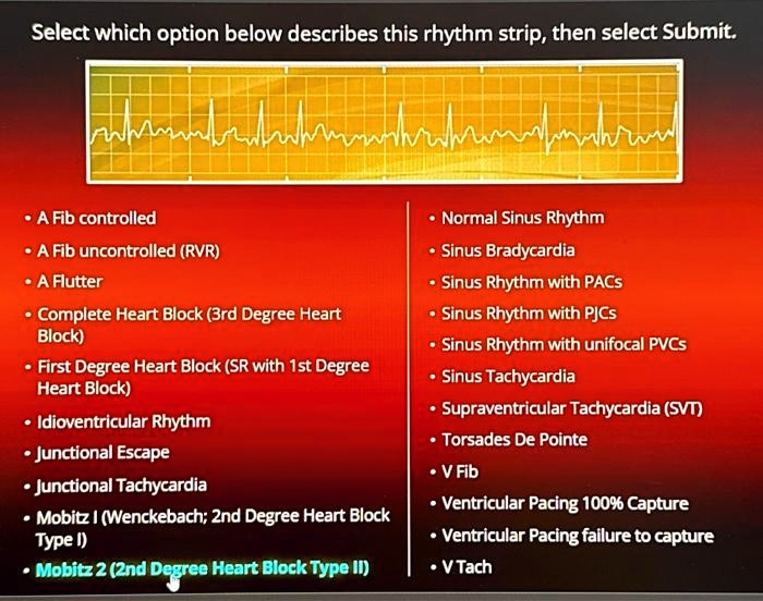 SOLVED: Select which option below describes this rhythm strip, then ...