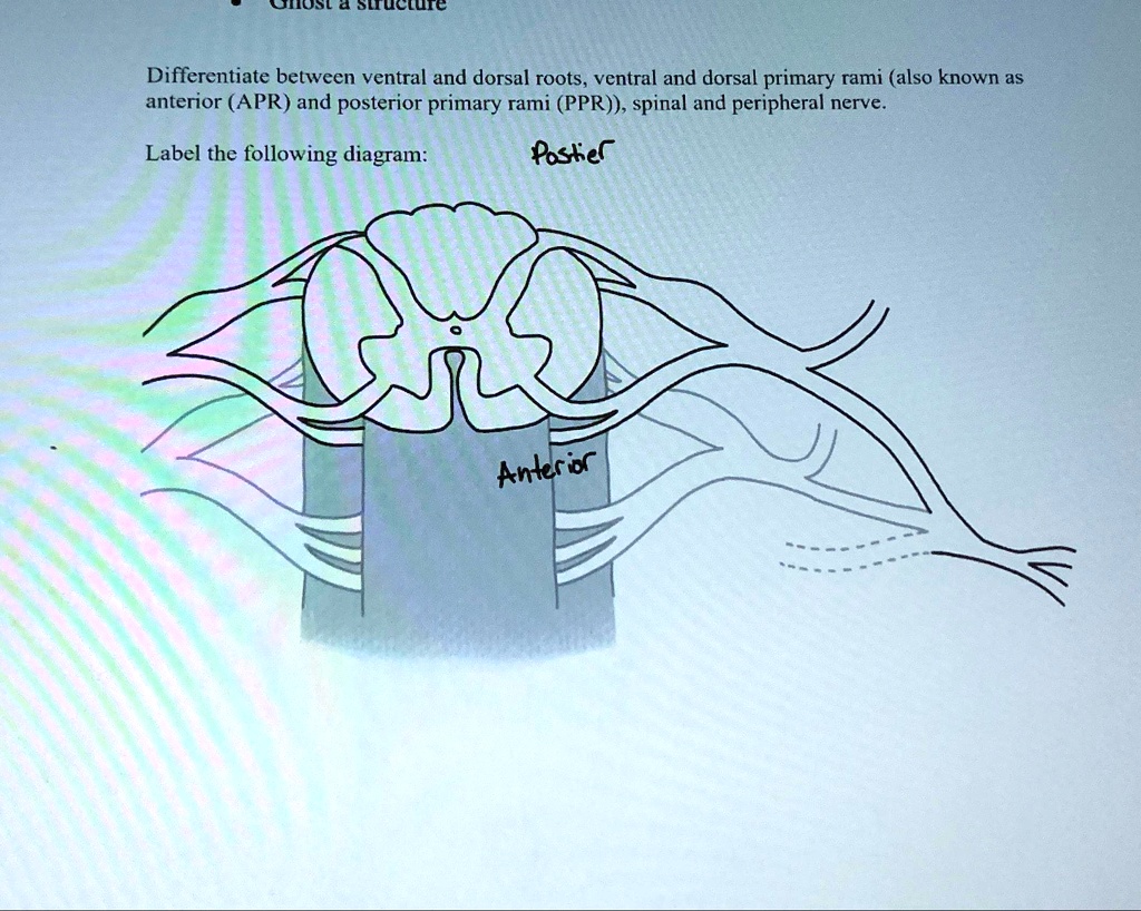 Solved Differentiate Between Ventral And Dorsal Roots Ventral And Dorsal Primary Rami Also