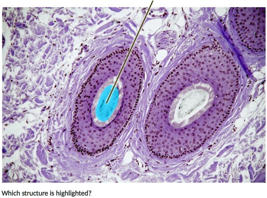 SOLVED: 'which structure is shown here? the medulla, the internal root ...