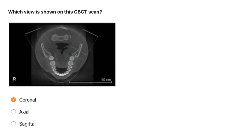 Coronal Sagittal Axial Views
