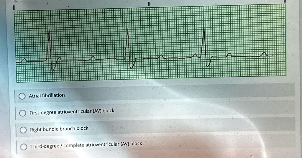 first degree av block with left bundle branch block icd 10