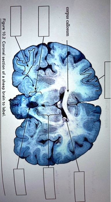 tentorium cerebelli sheep brain