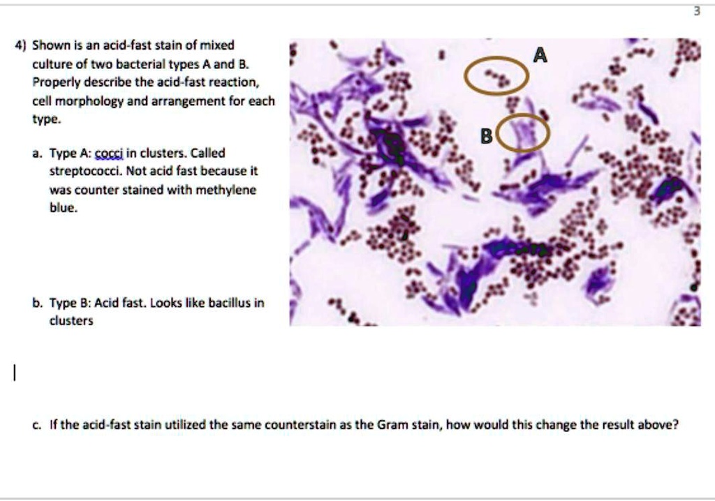 4) Shown is an acid-fast stain of a mixed culture of two bacterial ...