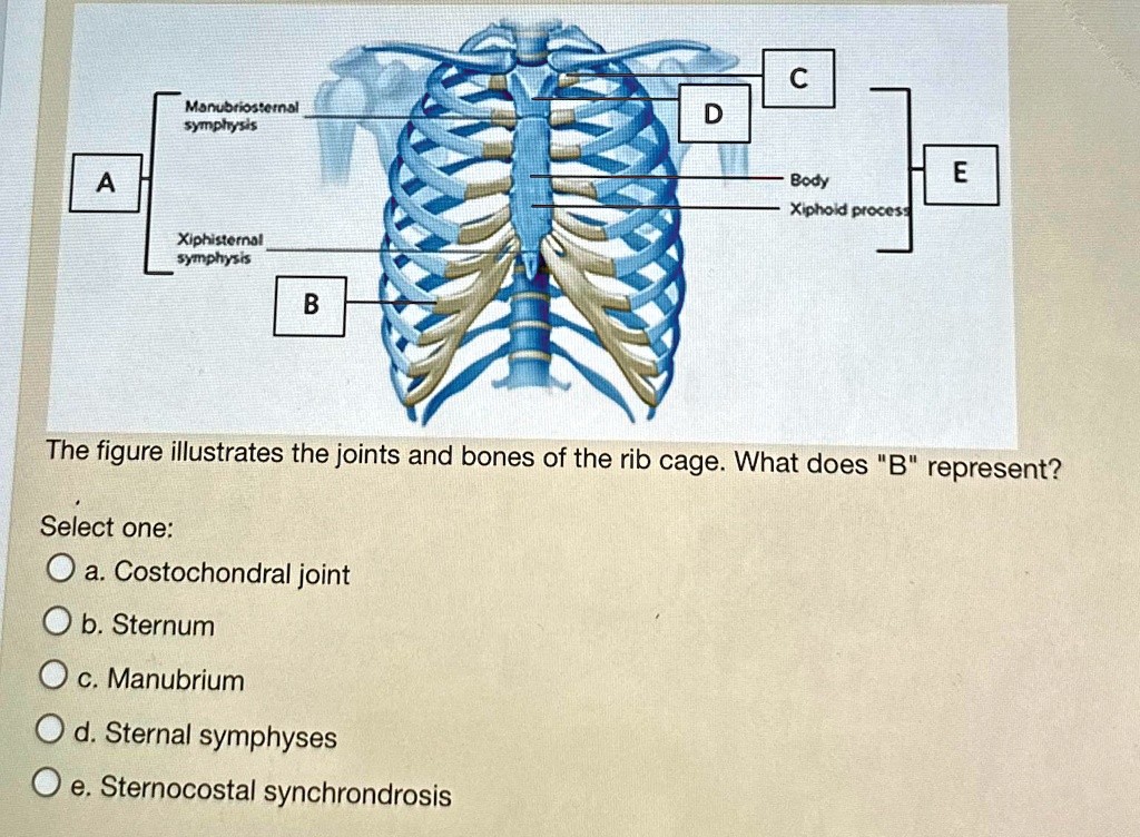 The figure illustrates the joints and bones of the rib cage. What does