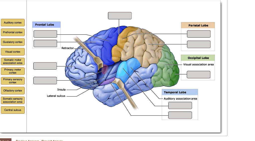 SOLVED: Auditory cortex Frontal Lobe Parietal Lobe Prefrontal cortex ...