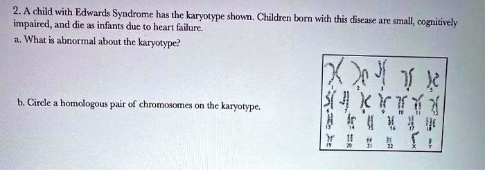 2. A child with Edwards Syndrome has the karyotype shown. Children born with this disease are small, cognitively impaired, and die as infants due to heart failure.
a. What is abnormal about the karyotype?
b. Circle a homologous pair of chromosomes on the karyotype.