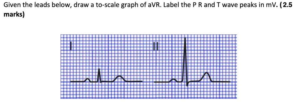 SOLVED: Given the leads below, draw a to-scale graph of aVR: Label the ...